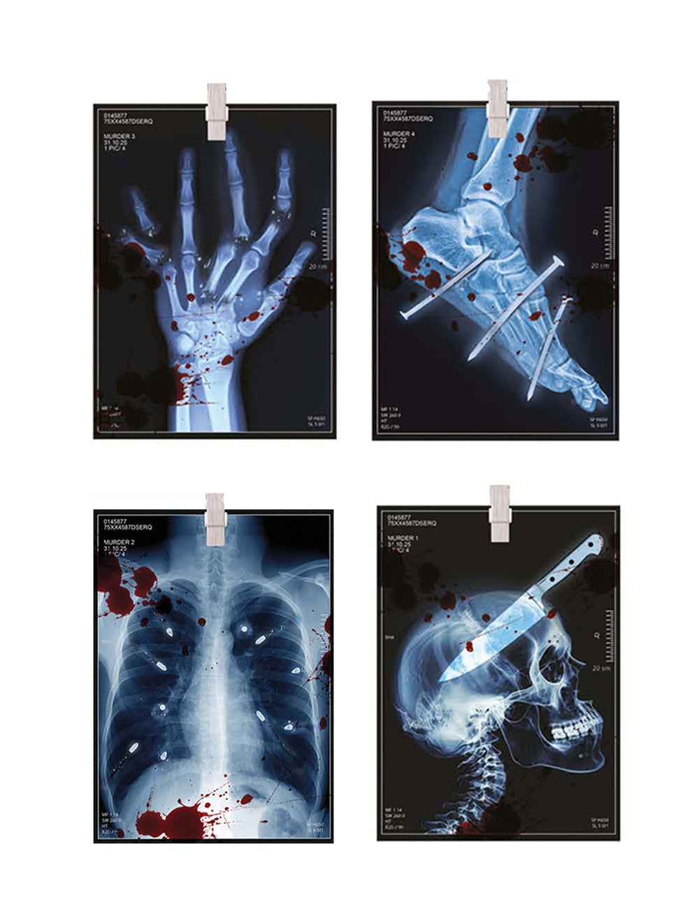Guirlande radiographies Halloween en papier bleue avec taches de sang